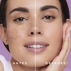 Triple Acción Max Aclarant Crema Facial Ésika 120g Todo Tipo De Piel Día/noche